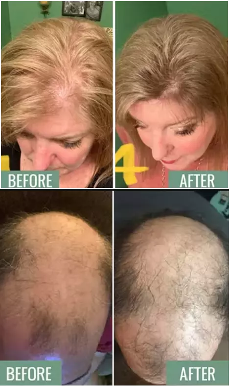 Primal Hair Growth Complex Before and After Reviews