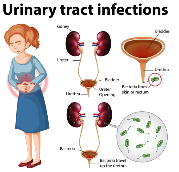 Treatment Urinary Tract Infection