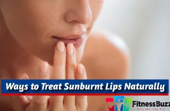 Ways to Treat Sunburnt Lips Naturally.