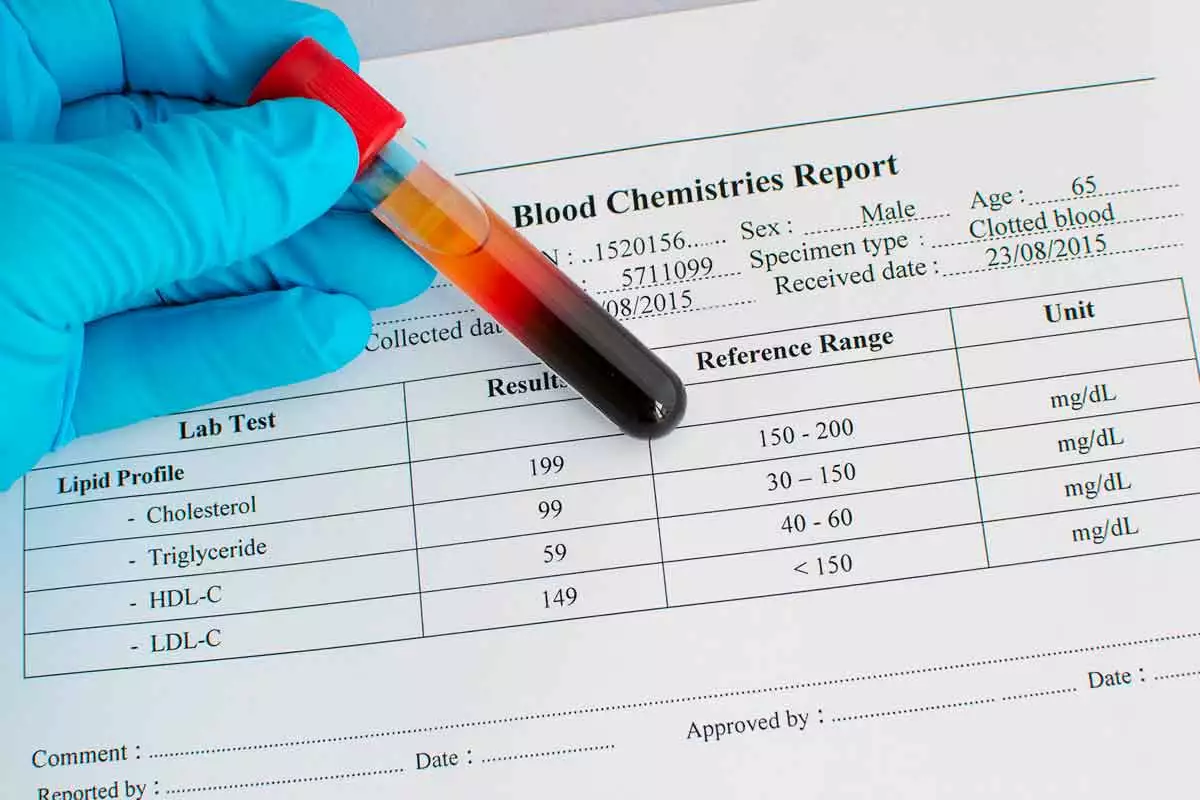 Low levels of “good” cholesterol